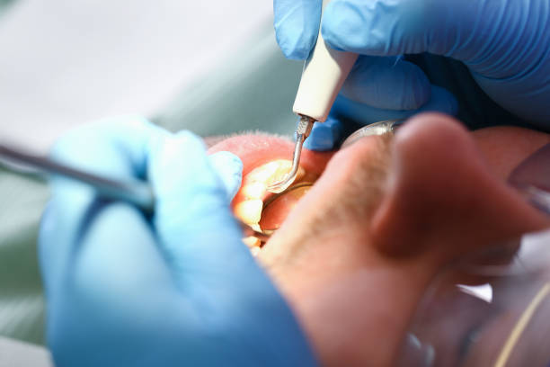 Best Broken or Chipped Tooth Repair in Paynesville, MN