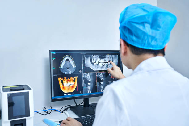 Best Emergency Wisdom Tooth Extraction in Paynesville, MN